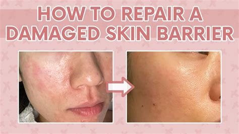 How Long Does İt Take To Repair Skin Barrier