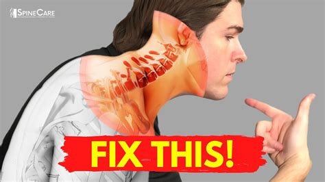 How To Repair Bulging Disc İn Neck