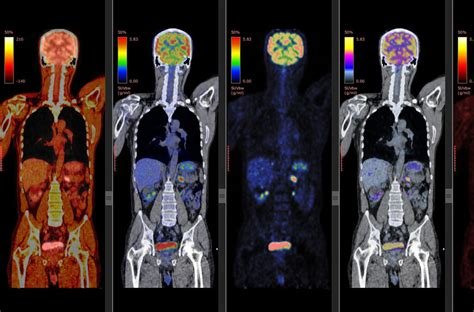 How To Repair Cells After Ct Scan